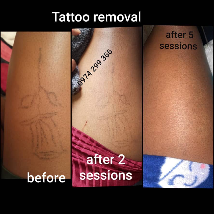 picture of tattoo